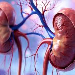 Can a Kidney Infection Start With Cystitis?