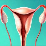 Can bladder flares occur during ovulation and PMS?