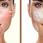 Common Triggers Found in Popular Skincare Brands