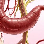 Does Chronic Fatigue Worsen Bladder Pain?