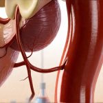 How to cope with medical gaslighting around bladder issues