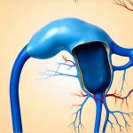 How to know if you’re experiencing bladder nerve misfiring