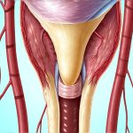 How to Tell If It’s a Flare or a New Infection
