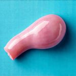 Is There a Link Between Cystitis and IBS?