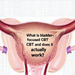 What is bladder-focused CBT and does it actually work?