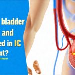 What is bladder pacing and is it used in IC treatment?