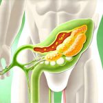 What is the role of oxalates in bladder irritation?