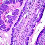 What role do mast cells play in bladder inflammation?