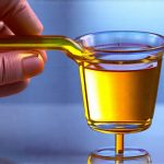 What your urine color might be telling you during a flare-up