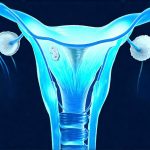 Why Cystitis Comes Back After Treatment