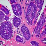 Hidden Causes of Recurring Prostate Inflammation