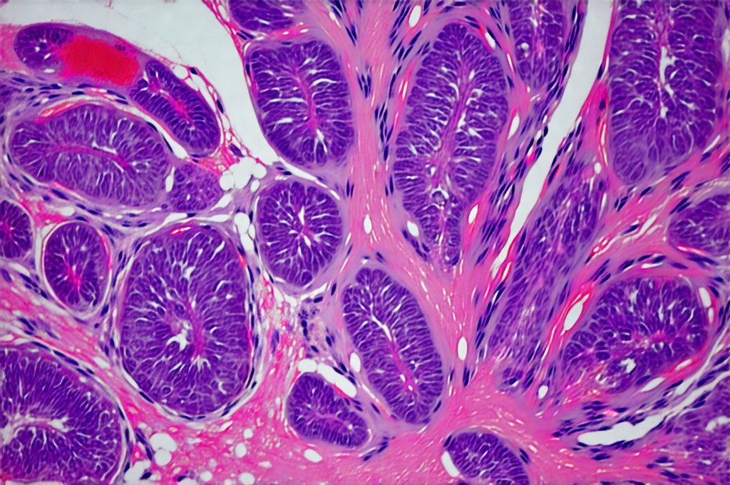 Hidden Causes of Recurring Prostate Inflammation