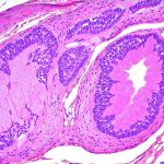 Microcirculation Issues in the Prostate Area